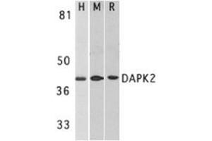Western blot analysis of DAPK2 in A431 (H), mouse spleen (M), and rat kidney (R) lysates with AP30272PU-N DAPK2 antibody at 1 μg/ml. (DAPK2 抗体)