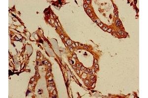 Immunohistochemistry (IHC) image for anti-5-Aminoimidazole-4-Carboxamide Ribonucleotide Formyltransferase/IMP Cyclohydrolase (ATIC) (AA 301-592) antibody (ABIN7145576)