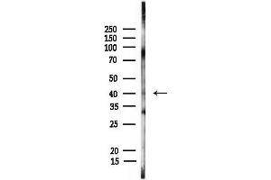 Western blot analysis of lysates from Rat liver, using p70 S6 Kinase beta Antibody at 1/1000 dilution.
