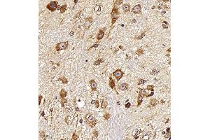 Immunohistochemistry (Paraffin-embedded Sections) (IHC (p)) image for anti-Neurotensin (NTS) antibody (ABIN7074827)