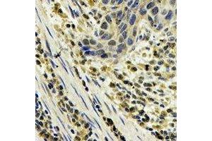 Immunohistochemistry (IHC) image for anti-S100 Calcium Binding Protein A8 (S100A8) antibody (ABIN7308306) (S100A8 抗体)