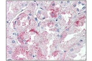 Immunohistochemistry: GPR146 antibody staining of Formalin-Fixed, Paraffin-Embedded Human Kidney.
