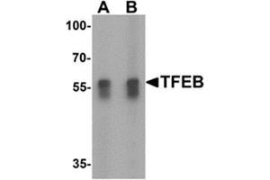 Western blot analysis of TFEB in A549 cell lysate with TFEB antibody at (A) 1 and (B) 2 ug/mL. (TFEB 抗体  (N-Term))