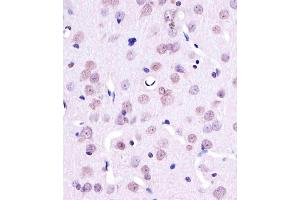 A staining YY1 in Rat brain tissue sections by Immunohistochemistry (IHC-P - paraformaldehyde-fixed, paraffin-embedded sections). (YY1 抗体)