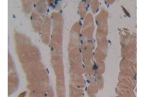 DAB staining on IHC-P; Samples: Mouse Skeletal muscle Tissue (MYH2 抗体  (AA 1238-1472))
