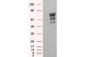 Western Blotting (WB) image for phosphodiesterase 4D, cAMP-Specific (PDE4D) peptide (ABIN370400) (phosphodiesterase 4D, cAMP-Specific (PDE4D) Peptide)