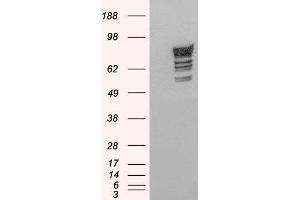 Western Blotting (WB) image for phosphodiesterase 4D, cAMP-Specific (PDE4D) peptide (ABIN370400)