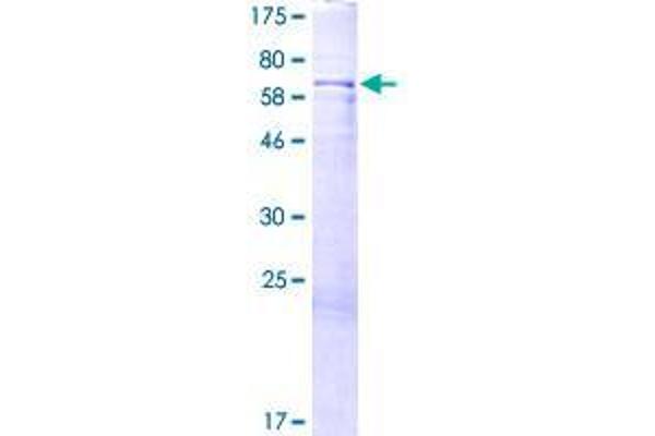 MIIP Protein (AA 1-388) (GST tag)