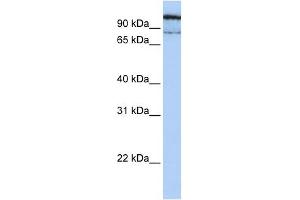 GAA antibody used at 1 ug/ml to detect target protein. (GAA 抗体  (N-Term))