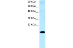 Western Blotting (WB) image for anti-Cbp/p300-Interacting Transactivator, with Glu/Asp-Rich Carboxy-terminal Domain, 1 (CITED1) antibody (ABIN2460540) (CITED1 抗体)
