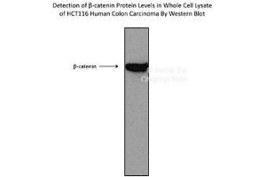 Sample Type :  HCT116 cell lysate CTNNB1 is supported by BioGPS gene expression data to be expressed in HCT116