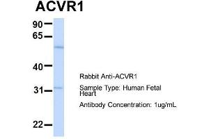Host:  Rabbit  Target Name:  ACVR1  Sample Type:  Human Fetal Heart  Antibody Dilution:  1. (ACVR1 抗体  (N-Term))