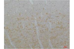 Immunohistochemistry (IHC) image for anti-Calcium Channel, Voltage Dependent, T Type, alpha 1I Subunit (CACNA1I) antibody (ABIN3181663)