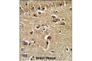 Immunohistochemistry (Paraffin-embedded Sections) (IHC (p)) image for anti-Exportin, tRNA (Nuclear Export Receptor For TRNAs) (XPOT) (AA 935-962), (C-Term) antibody (ABIN391953)