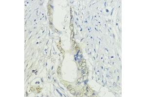 Immunohistochemistry (IHC) image for anti-Bromodomain Adjacent To Zinc Finger Domain, 2A (BAZ2A) antibody (ABIN7265937)