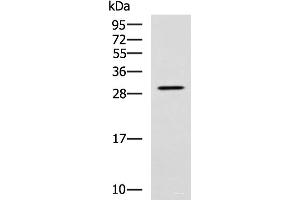 Western blot analysis of SP20 cell lysate using LRAT Polyclonal Antibody at dilution of 1:800 (LRAT 抗体)