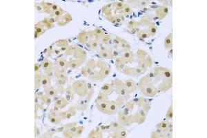 Immunohistochemistry of paraffin-embedded human stomach using SMEK1 antibody. (SMEK1 抗体  (AA 395-594))