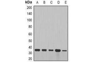 Western blot analysis of Cyclin D2 expression in SW480 (A), NIH3T3 (B), mouse brain (C), mouse lung (D), rat heart (E) whole cell lysates. (Cyclin D2 抗体)