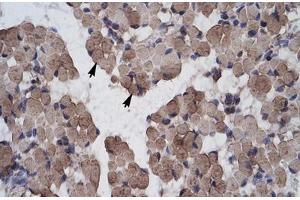 Immunohistochemical staining (Formalin-fixed paraffin-embedded sections) of human muscle with LHX9 polyclonal antibody . (LHX9 抗体  (AA 324-373))