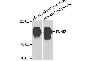 Western blot analysis of extracts of various cell lines, using TNNI2 antibody. (TNNI2 抗体  (AA 1-100))