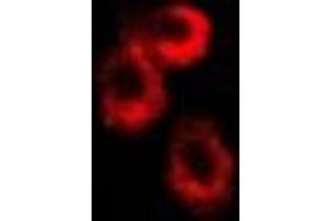 Immunofluorescent analysis of RISP staining in U2OS cells. (UQCRFS1 抗体)