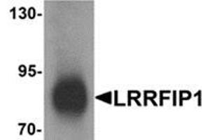 Western blot analysis of LRRFIP1 in human colon tissue lysate with LRRFIP1 antibody at 1 μg/ml. (LRRFIP1 抗体  (C-Term))