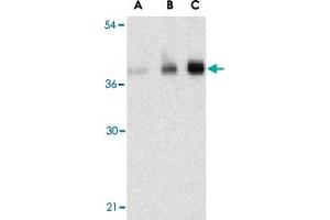 Western blot analysis of C1QTNF5 in human brain tissue lysate with C1QTNF5 polyclonal antibody  at (A) 1, (B) 2, and (C) 4 ug/mL . (CTRP5 抗体  (N-Term))