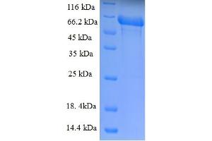 SDS-PAGE (SDS) image for Transmembrane Protease, serine 4 (TMPRSS4) (AA 52-435) protein (His-SUMO Tag) (ABIN5711624) (TMPRSS4 Protein (AA 52-435) (His-SUMO Tag))