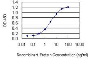 Detection limit for recombinant GST tagged GGT1 is 0. (GGT1 抗体  (AA 381-470))