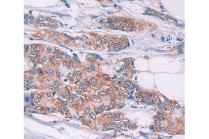 Used in DAB staining on fromalin fixed paraffin- embedded Kidney tissue (TPM2 抗体  (AA 1-284))