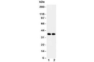 Western blot testing of APEX1 antibody and Lane 1:  rat brain;  2: mouse brain tissue lysate. (APEX1 抗体  (Middle Region))