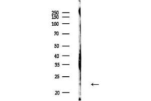 anti-RAB8A, Member RAS Oncogene Family (RAB8A) (pThr72) antibody
