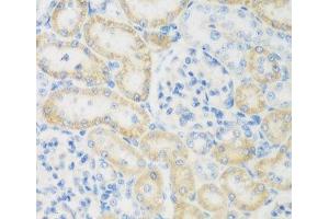 Immunohistochemistry of paraffin-embedded Rat kidney using NAT8B Polyclonal Antibody at dilution of 1:200 (40x lens). (NAT8B 抗体)