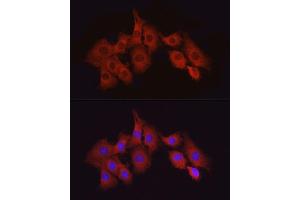 Immunofluorescence analysis of PC-12 cells using T Rabbit pAb (ABIN6130537, ABIN6143503, ABIN6143504 and ABIN6215581) at dilution of 1:50 (40x lens). (MAP3K7 抗体  (AA 300-470))