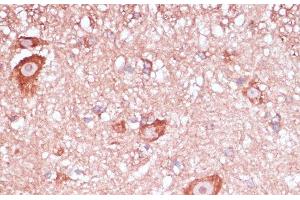 Immunohistochemistry (Paraffin-embedded Sections) (IHC (p)) image for anti-Ribosomal Protein L32 (RPL32) antibody (ABIN7256518)