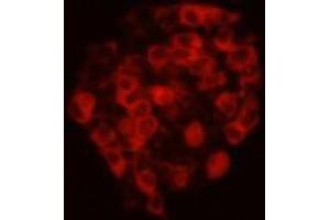 Immunocytochemistry (ICC) image for anti-Cadherin EGF LAG Seven Pass G-Type Receptor 2 (CELSR2) antibody (ABIN1112870) (CELSR2 抗体)