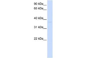 GDAP1L1 antibody used at 1 ug/ml to detect target protein. (GDAP1L1 抗体  (N-Term))