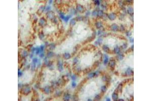 Used in DAB staining on fromalin fixed paraffin-embedded Kidney tissue (CHD3 抗体  (AA 1551-1742))