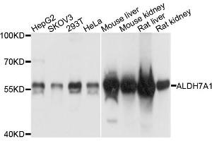 Western blot analysis of extracts of various cells, using ALDH7A1 antibody. (ALDH7A1 抗体)