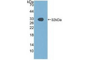 Detection of Recombinant PAK1, Human using Polyclonal Antibody to p21 Protein Activated Kinase 1 (PAK1) (PAK1 抗体  (AA 252-501))