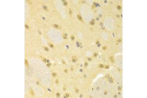 Immunohistochemistry of paraffin-embedded rat brain using SMAD1 antibody.