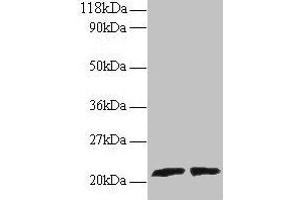 Western blot All lanes: ARL2 antibody at 2 μg/mL Lane 1: EC109 whole cell lysate Lane 2: 293T whole cell lysate Secondary Goat polyclonal to rabbit IgG at 1/15000 dilution Predicted band size: 21, 19 kDa Observed band size: 21 kDa (ARL2 抗体  (AA 19-184))