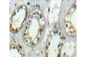 Used in DAB staining on fromalin fixed paraffin-embedded Kidney tissue (ITGAD 抗体  (AA 886-1106))