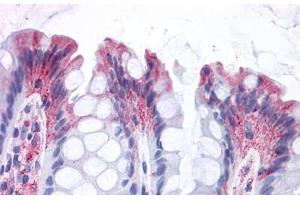 GPR82 抗体  (Cytoplasmic Domain)