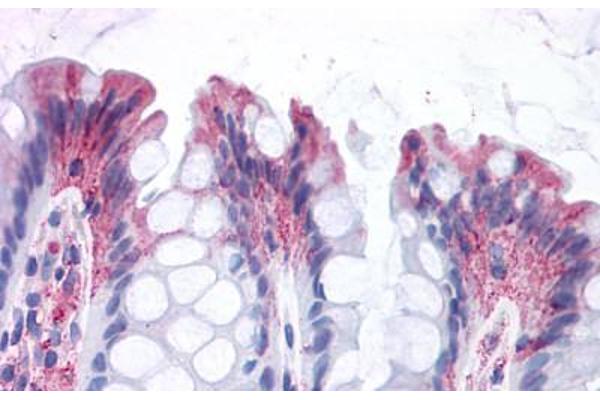 GPR82 抗体  (Cytoplasmic Domain)