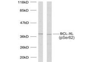 Western blot analysis of extracts from 293 cells treated with UV and MDA-MB-435 cells treated with UV, using BCL-XL (Phospho-Ser62) Antibody. (BCL2L1 抗体  (pSer62))