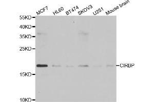 Western blot analysis of extracts of various cell lines, using CIRBP antibody (ABIN5973938) at 1/1000 dilution. (CIRBP 抗体)