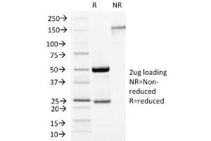 SDS-PAGE Analysis Purified Growth Hormone Mouse Monoclonal Antibody (GH/1450). (Growth Hormone 1 抗体  (AA 58-187))