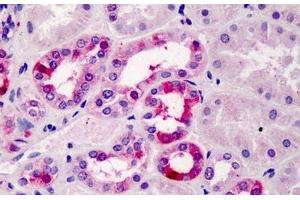 ABIN334506 (5µg/ml) staining of paraffin embedded Human Kidney. (TFEC 抗体  (Internal Region))