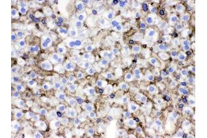 Immunohistochemistry (IHC) image for anti-Solute Carrier Family 10 (Sodium/bile Acid Cotransporter Family), Member 1 (SLC10A1) (AA 296-336), (C-Term) antibody (ABIN3043337)